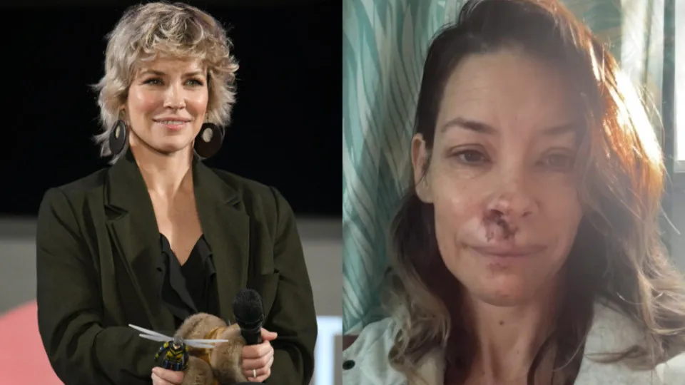 Evangeline Lilly, estrela de ‘Lost’, sofre acidente na praia Evangeline Lilly, estrela de ‘Lost’, sofre acidente na praia