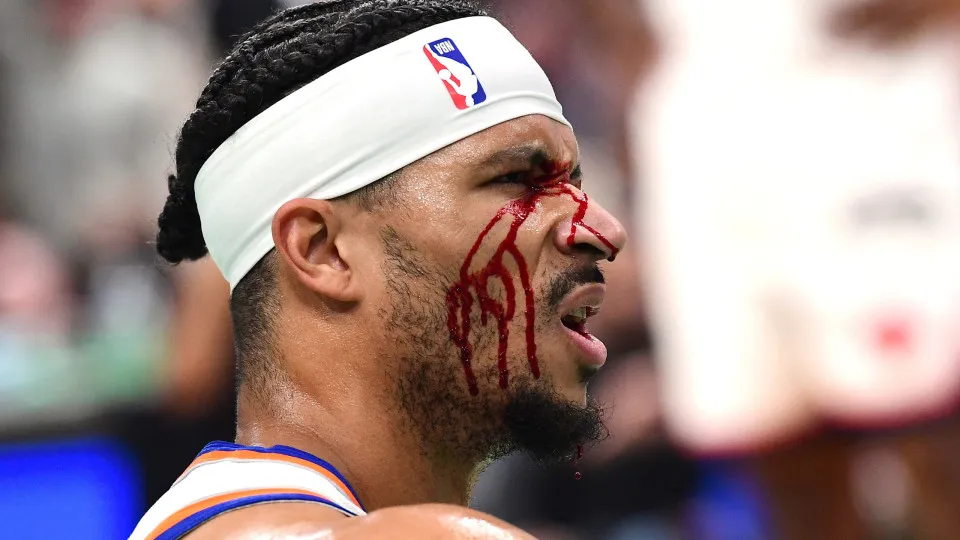 Jogador dos New York Knicks fica sangrando após cotovelada Jogador dos New York Knicks fica sangrando após cotovelada