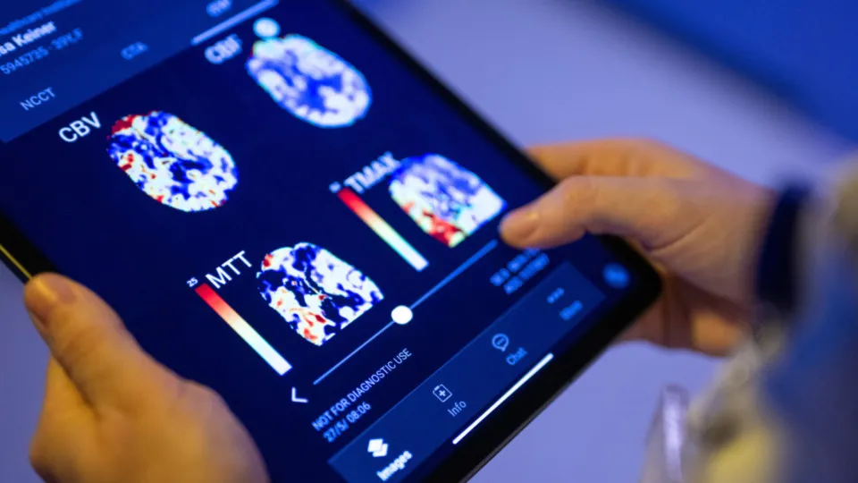 Qual é o limite da Inteligência Artificial? Ler mentes e prever mortes já é realidade