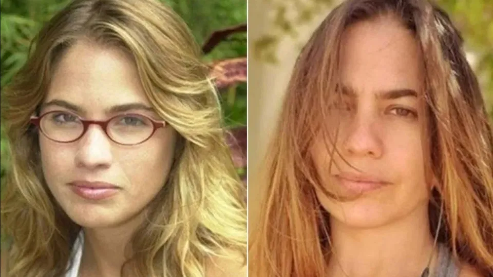 Atriz de malhação fica cega após ser agredida e expõe abusos Atriz de malhação fica cega após ser agredida e expõe abusos