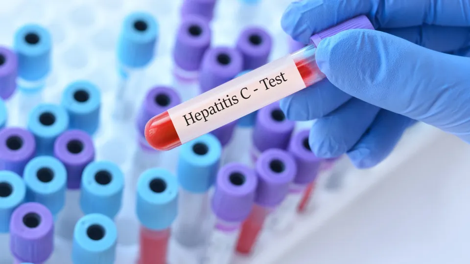 Hepatite C pode estar ligada a transtornos mentais, diz novo estudo