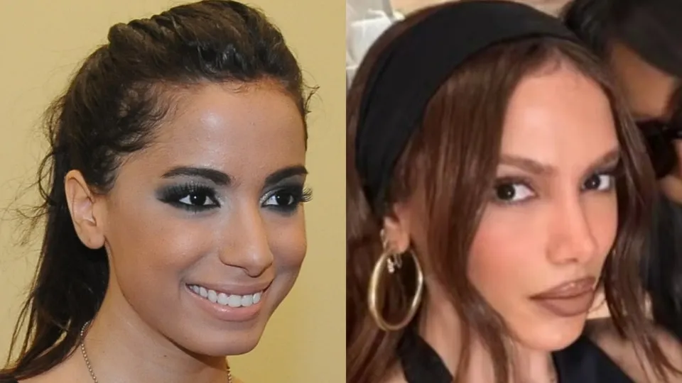 Ranking dos países que mais fazem cirurgia plástica