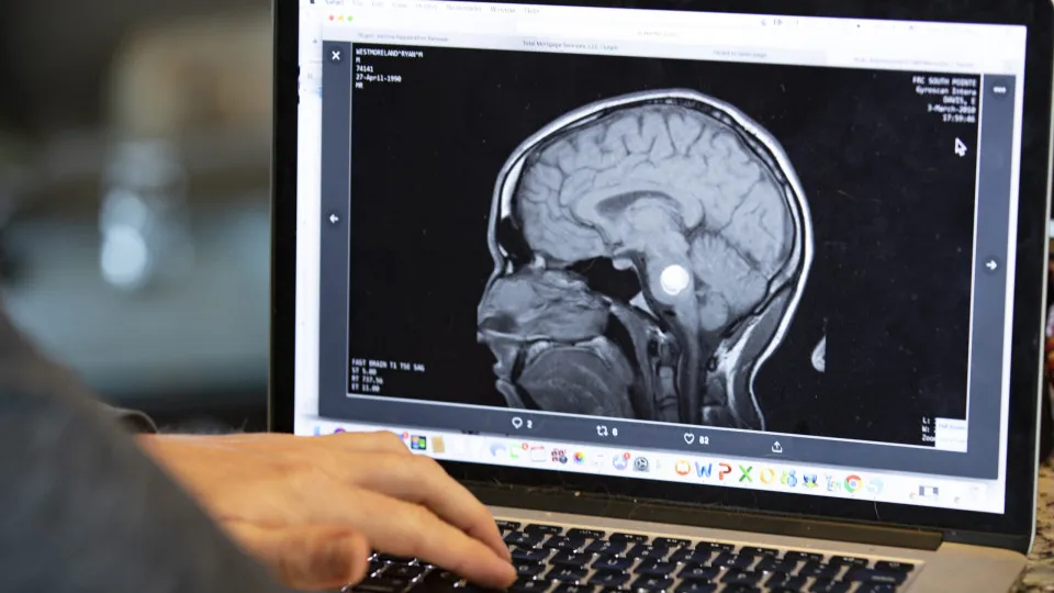 Você usa mais o lado direito ou esquerdo do cérebro?