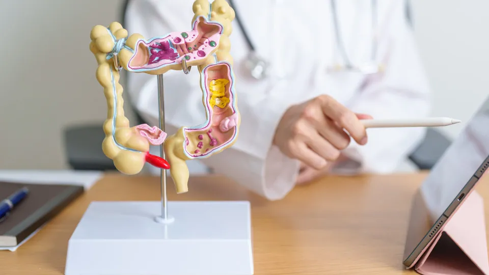 Medicamento comum mostra resultados promissores contra câncer colorretal