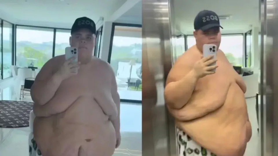 Gordão da XJ comemora após perder 115 kg Gordão da XJ comemora após perder 115 kg